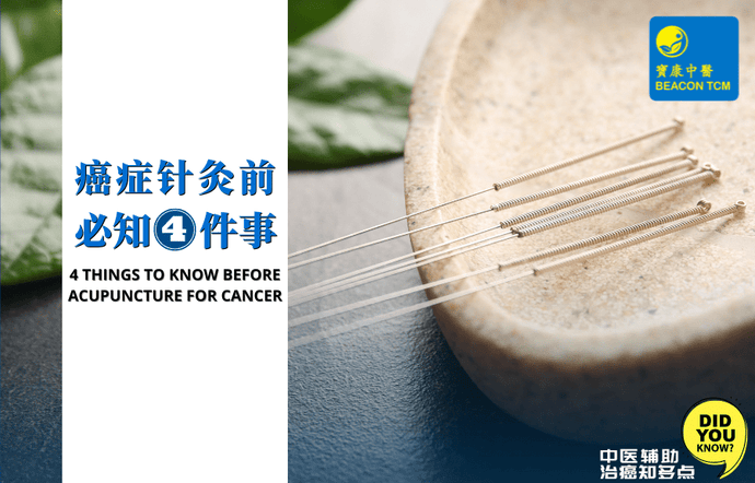 4 Things To Know Before Acupuncture For Cancer